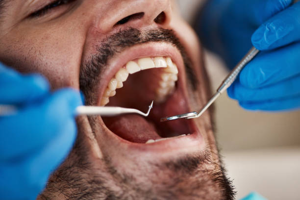 Best Emergency Dental Care for Sports Injuries in Charleston, MO
